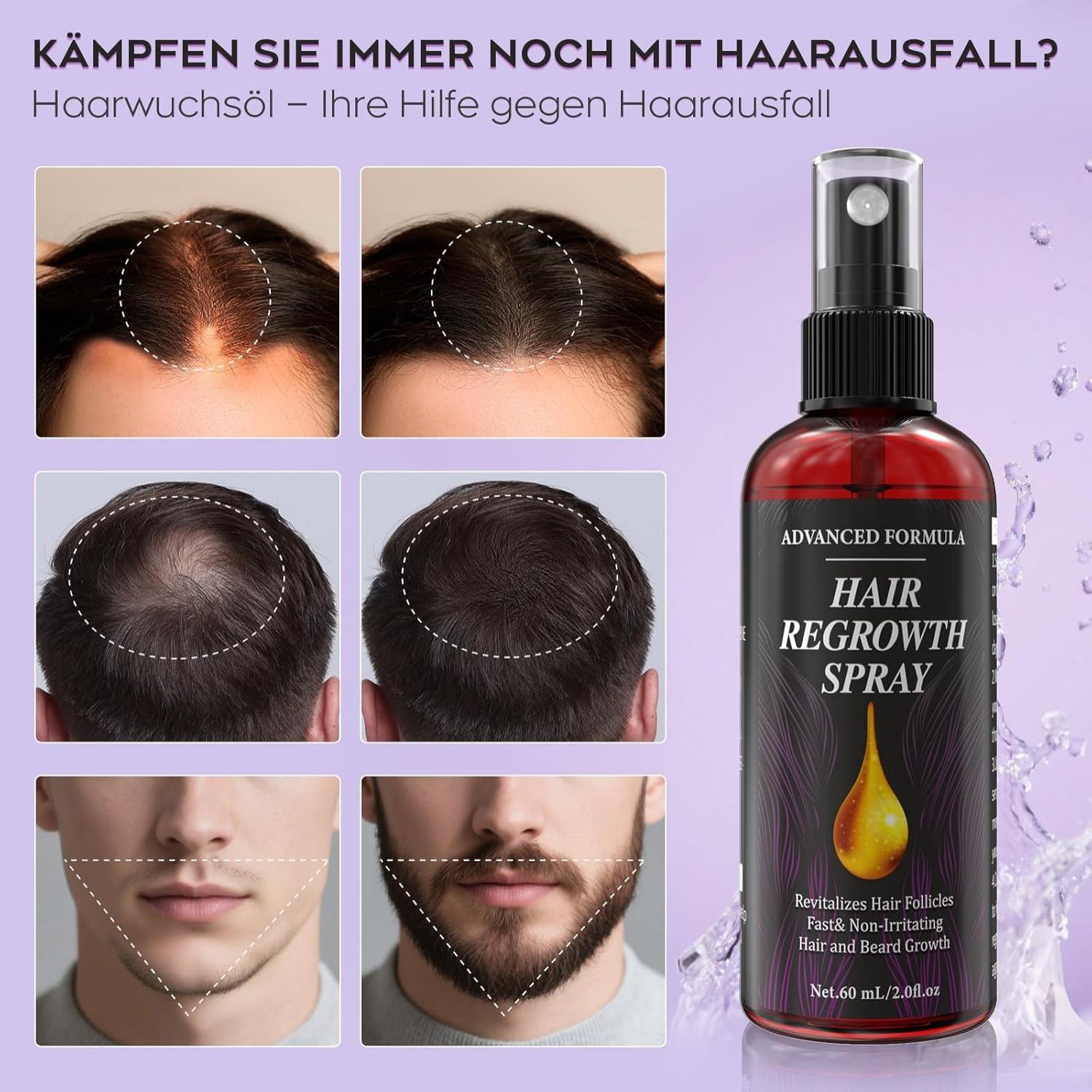 Voltuno Hair Loss Treatment for Men & Women, Hair Growth Accelerating Spray, Shiny Hair Growth Booster, with Rosemary Oil and Organic Castor Oil Extract, for Extremely Damaged Hair, Gentle and Non-Drying, 60ml